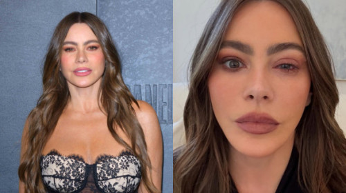 De ce Sofia Vergara a ratat Premiile Emmy 2025. Actrița a ajuns de urgență la spital aproape desfigurată: „O reacție alergică”