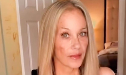 „Sunt încă în stare de şoc”. Christina Applegate, diagnosticată greșit cu scleroză multiplă: M-am întors la punctul zero