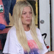EXCLUSIVE: **PREMIUM EXCLUSIVE RATES APPLY** Bruised And Battered Tori Spelling Leaves The Hospital In A Wheelchair With Visible Marks On Her Face And Arms After Mystery Accident