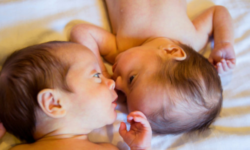 Experimentul controversat în care gemenii identici au fost despărțiți în secret la naștere