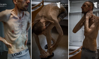 Imagini șocante cu un prizonier ucrainean după doi ani de captivitate în Rusia. „Evocă cele mai întunecate pagini ale istoriei umane”