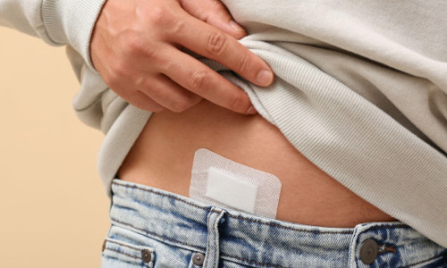 O formă de cancer extrem de rară afectează acum tot mai mulți tineri. Medicii nu știu care e explicația și sunt îngrijorați