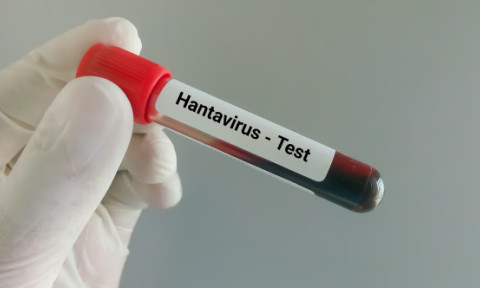 Ce este hantavirusul, infecția care a provocat trei decese pe o navă de croazieră. Ce riscuri există în România
