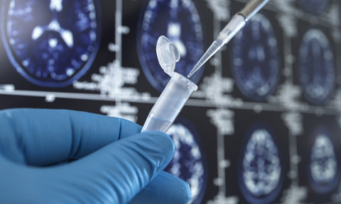 Un vaccin folosit de zeci de ani ar putea proteja creierul împotriva demenței. Descoperirea cercetătorilor americani
