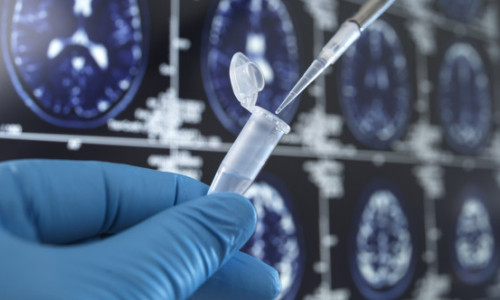 Un vaccin folosit de zeci de ani ar putea proteja creierul împotriva demenței. Descoperirea cercetătorilor americani