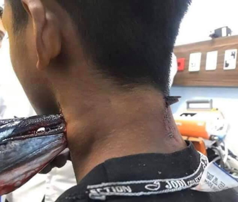 zargan-injunghiat-gat-indonezia
