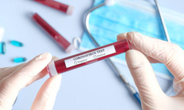 Probe trimise pe pile și relații politice, pentru a fi testate pentru coronavirus la „Matei Balș”. Institutul este sufocat
