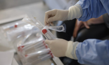 Informații în premieră despre testele COVID-19. Cine sunt persoanele testate și cum se raportează datele