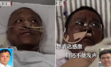 Ce s-a întâmplat cu unul dintre medicii chinezi care s-a înnegrit din cauza tratamentului pentru Covid-19
