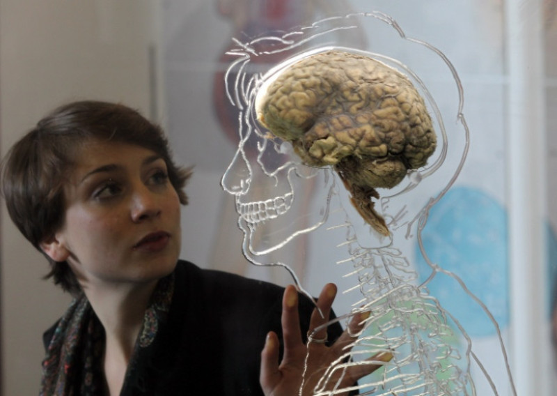 creier neurologie