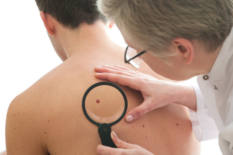 barbat cancer piele doctor shutterstock_121287184