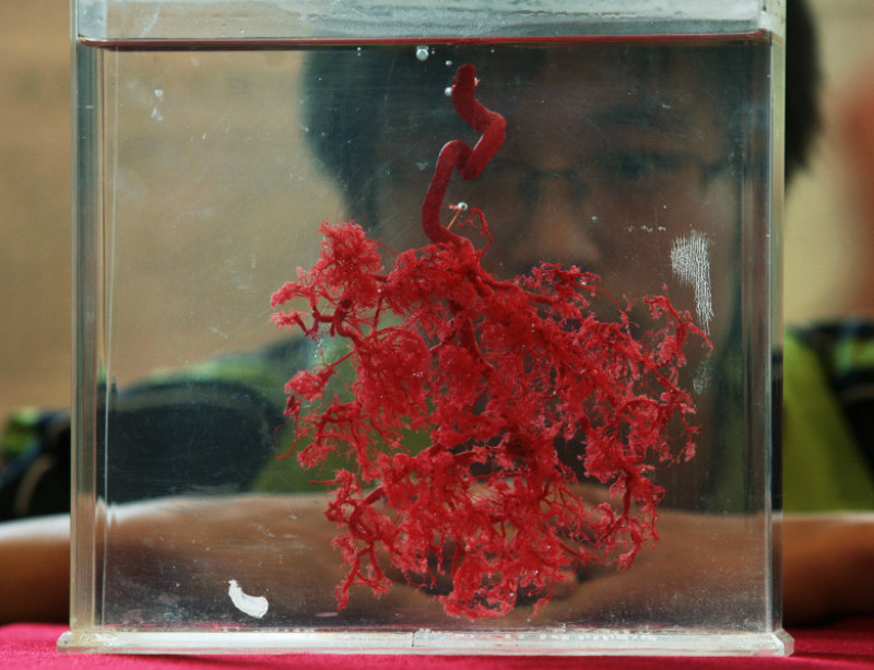 Vase de sânge