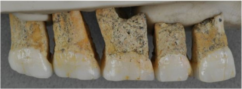 homo luzonensis