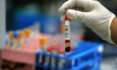 Breaking news: Explozie la unul dintre cele mai periculoase locuri de pe Pământ, unde se păstrează viruși de variolă, Ebola și HIV