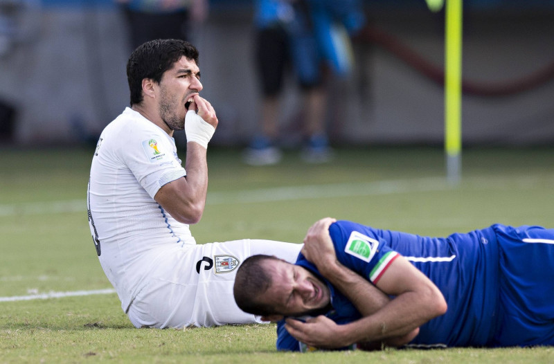 Natal 24 06 2014 Arena Das Dunas Luiz Suarez Uruguay hält sich die Zähne nach seiner Beißattacke