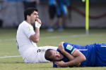 Natal 24 06 2014 Arena Das Dunas Luiz Suarez Uruguay hält sich die Zähne nach seiner Beißattacke