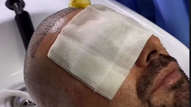 Adi Mutu și-a făcut implant de păr. Răchită a stârnit hohote de râs când a aflat, "Briliantul" i-a dat imediat replica
