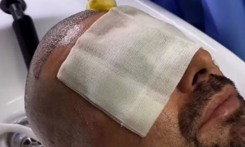 Adi Mutu și-a făcut implant de păr. Răchită a stârnit hohote de râs când a aflat, 