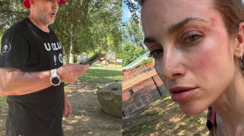 Un bărbat a bătut o femeie în parc, de față cu fiica ei: ”A recurs la un gest josnic”. Agresorul: ”Să-ți închizi gura”