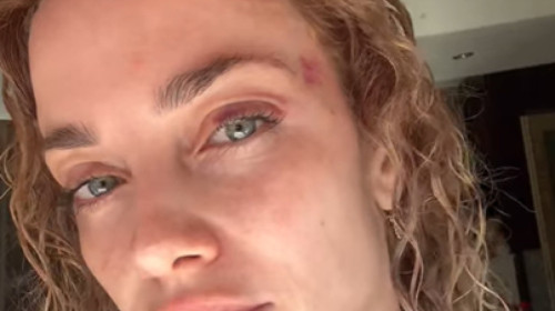 Decizia luată de femeia agresată de un bărbat în parc, în fața fetiței ei. Imagini cu impact emoțional