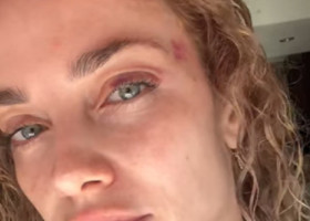 Decizia luată de femeia agresată de un bărbat în parc, în fața fetiței ei. Imagini cu impact emoțional