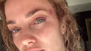 Decizia luată de femeia agresată de un bărbat în parc, în fața fetiței ei. Imagini cu impact emoțional
