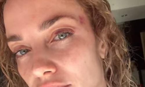 Decizia luată de femeia agresată de un bărbat în parc, în fața fetiței ei. Imagini cu impact emoțional