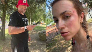 Lovitură de teatru în cazul femeii agresate în parc: "A făcut box! 3 oameni au intervenit, să o oprească!"