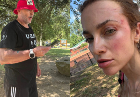 Lovitură de teatru în cazul femeii agresate în parc: "A făcut box! 3 oameni au intervenit, să o oprească!"