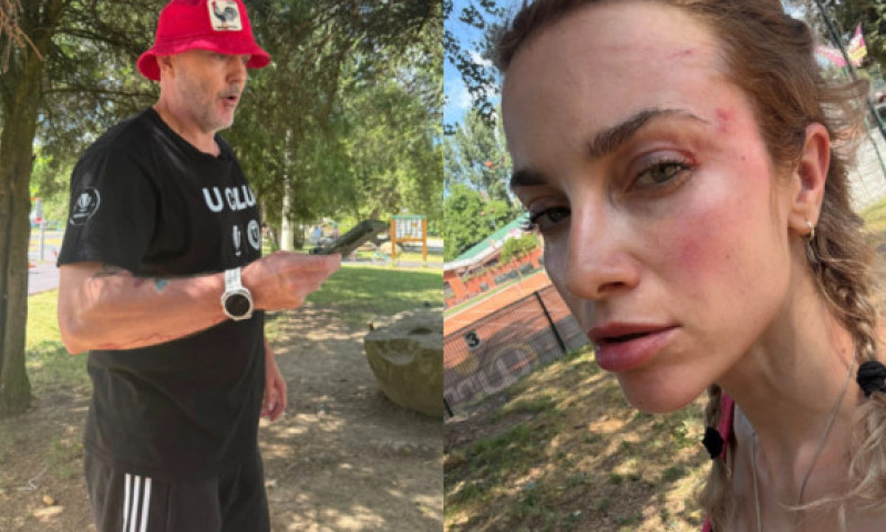 Lovitură de teatru în cazul femeii agresate în parc: "A făcut box! 3 oameni au intervenit, să o oprească!"