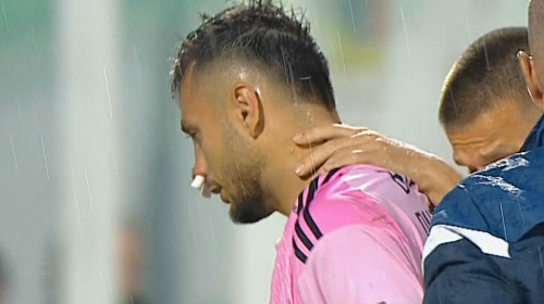 Cosmin Dur-Bozoancă, umplut de sânge de colegul de la Oțelul! Laszlo Balint nu a stat pe gânduri