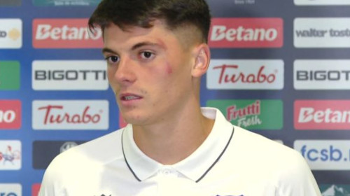 Cum arată jucătorul pe care Ngezana l-a făcut KO în meciul FCSB - FC Argeș: ”A făcut foarfecă direct în capul meu”