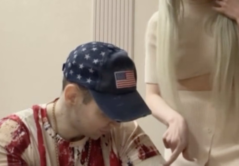 FOTO Neverosimil: și-a injectat ulei pentru a avea bicepși uriași și acum riscă să-și piardă ambele brațe! Cum a ajuns să arate