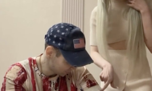 FOTO Neverosimil: și-a injectat ulei pentru a avea bicepși uriași și acum riscă să-și piardă ambele brațe! Cum a ajuns să arate