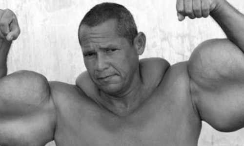 ”Popeye” a murit. Ce a făcut pentru a avea bicepși de 73 de centimetri: ”Nu sfătuiesc pe nimeni”