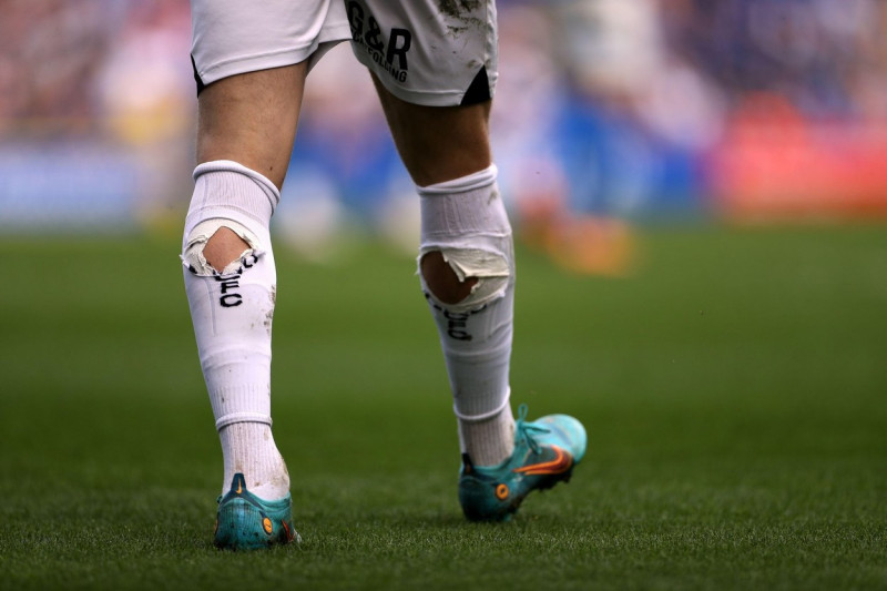 Holes in the socks of Coventry City's Viktor Gyokeres during the Sky Bet Championship match at St. Andrew's, Birmingham. Picture date: Friday April 15, 2022.