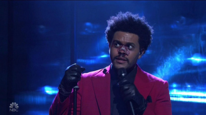 Abel Makkonen Aka The Weeknd delivers a 'Blinding' performance, completely with a blood and bandaged nose on Saturday Night Live
