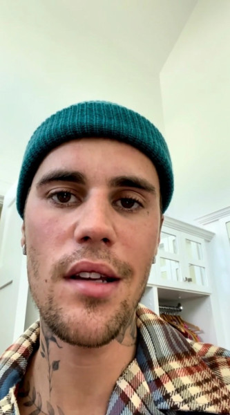 Justin Bieber a anulat concerte din cauza unei paralizii care îi afectează jumătate din faţă