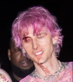 Machine Gun Kelly Leaves His After Party At Catch Steak House With A Bloody Face