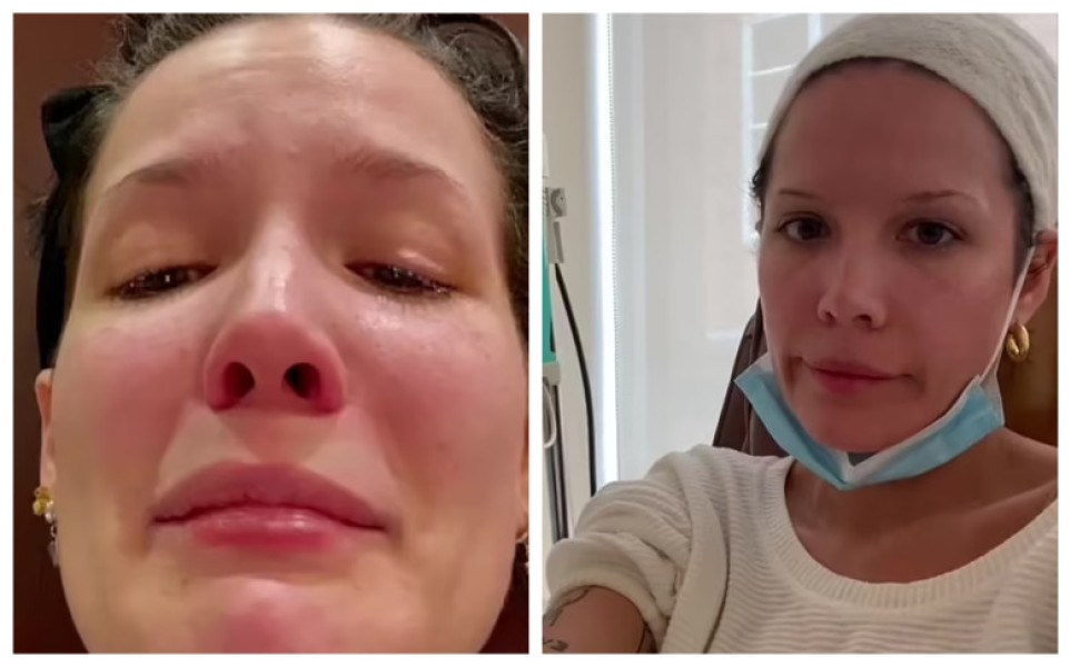 Halsey se confruntă cu noi probleme de sănătate
