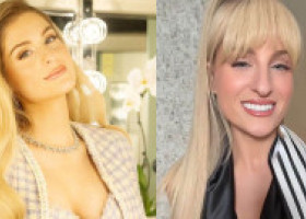 Meghan Trainor, greu de recunoscut până și de fani, după ce a slăbit și a făcut operații estetice: "Am crezut că e Paris Hilton"