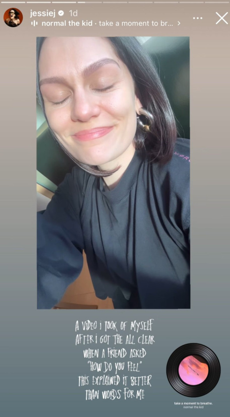 Jessie J 3