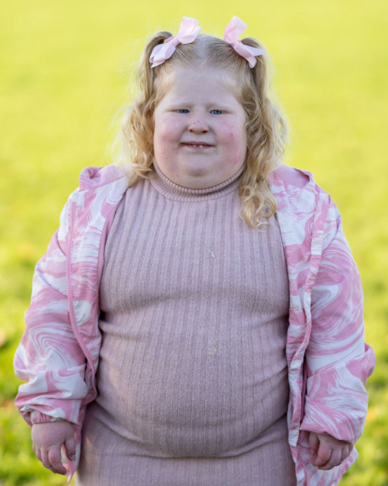 O fetiță a ajuns să cântărească 45 de kilograme la doar cinci ani
