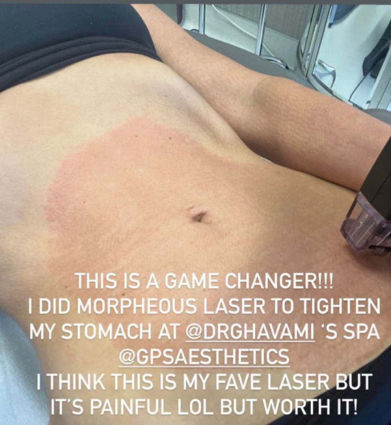 Kim Kardashian abdomen/ Foto: Instagram