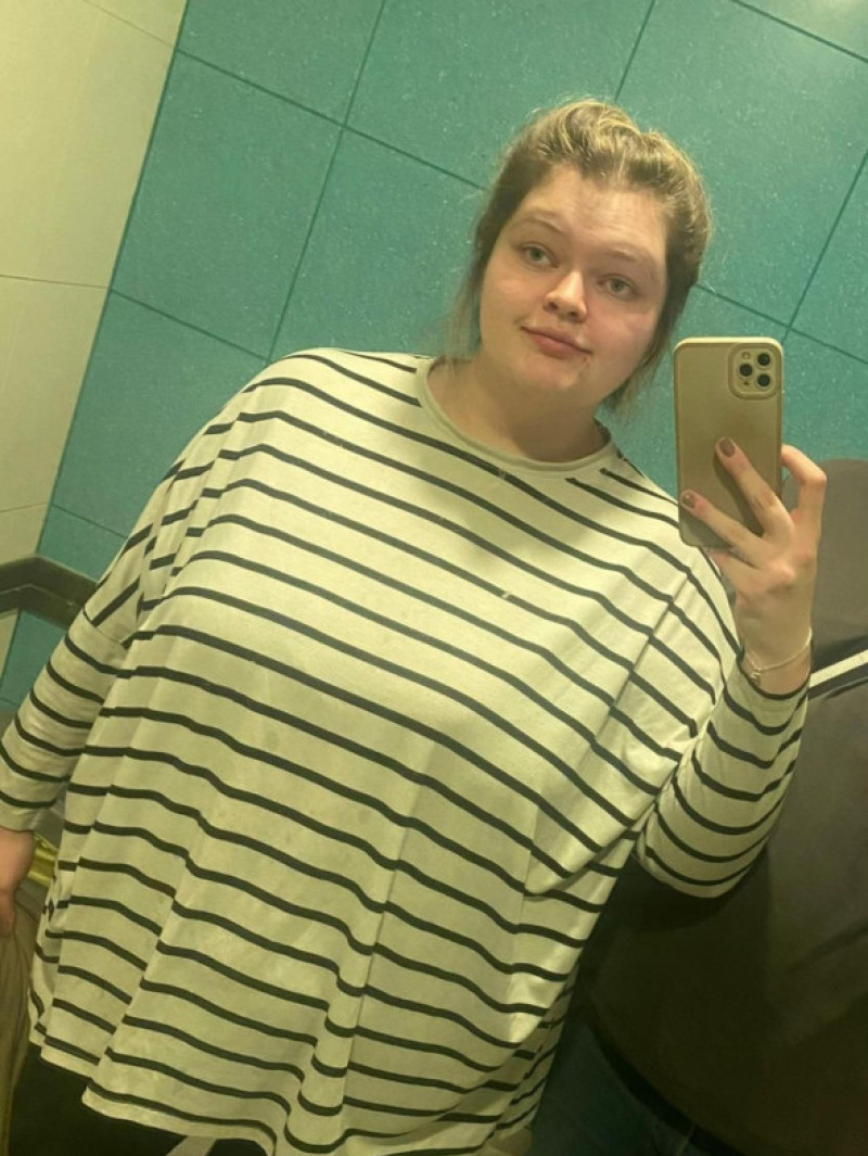 VIDEO: Woman, 26, shocks millions with Margot Robbie likeness after 12 stone weight loss