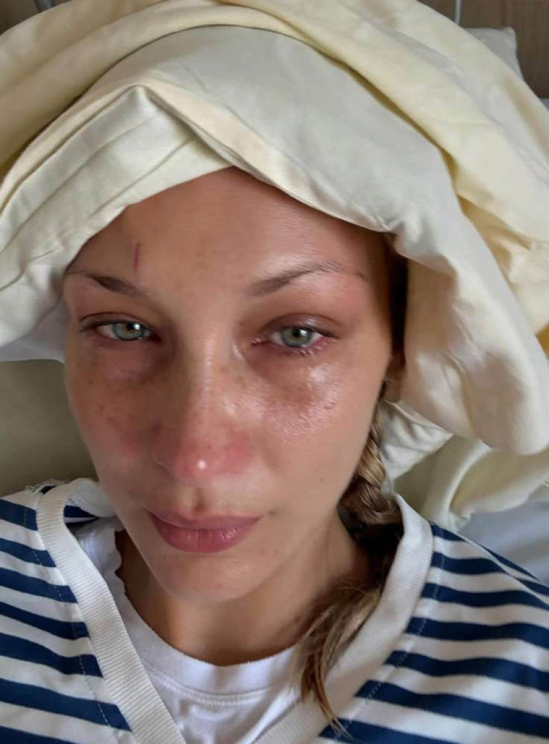 Bella Hadid/ Profimedia