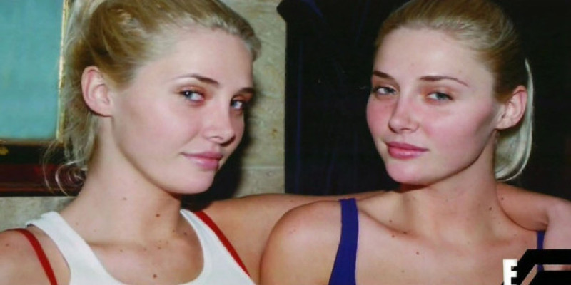Karissa și Kristina Shannon