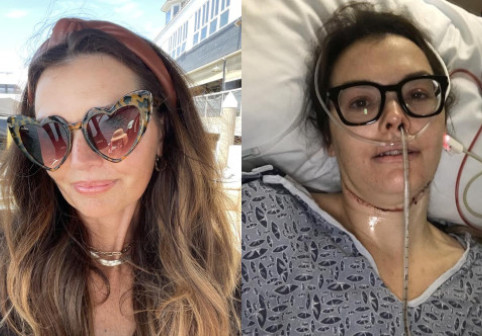 O femeie a fost ignorată de medici luni întregi, apoi a ajuns să facă 30 de ședințe de radiații: „Boala mi-a furat identitatea”