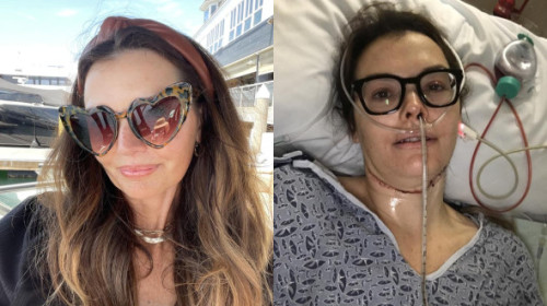 O femeie a fost ignorată de medici luni întregi, apoi a ajuns să facă 30 de ședințe de radiații: „Boala mi-a furat identitatea”