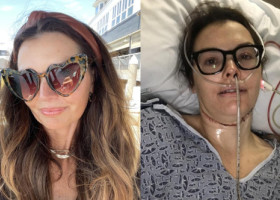 O femeie a fost ignorată de medici luni întregi, apoi a ajuns să facă 30 de ședințe de radiații: „Boala mi-a furat identitatea”